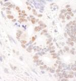 DDX24 Antibody in Immunohistochemistry (IHC)