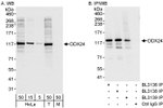 DDX24 Antibody in Western Blot (WB)