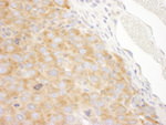 DDX3 Antibody in Immunohistochemistry (IHC)