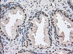 DDX39B Antibody in Immunohistochemistry (Paraffin) (IHC (P))