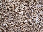 DDX39B Antibody in Immunohistochemistry (Paraffin) (IHC (P))