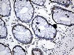 DDX39B Antibody in Immunohistochemistry (Paraffin) (IHC (P))