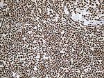 DDX39B Antibody in Immunohistochemistry (Paraffin) (IHC (P))