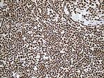 DDX39B Antibody in Immunohistochemistry (Paraffin) (IHC (P))