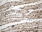 DDX39B Antibody in Immunohistochemistry (Paraffin) (IHC (P))