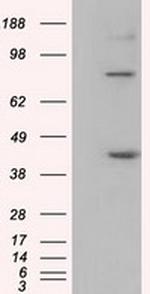 DDX39B Antibody in Western Blot (WB)