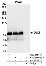 DDX5 Antibody in Western Blot (WB)