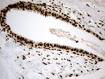 DDX50 Antibody in Immunohistochemistry (Paraffin) (IHC (P))