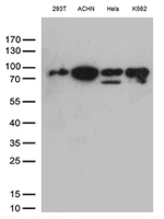 DDX50 Antibody in Western Blot (WB)