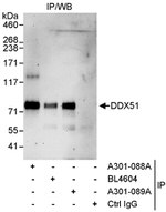 DDX51 Antibody in Immunoprecipitation (IP)