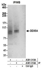 DDX54 Antibody in Immunoprecipitation (IP)