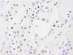 DDX54 Antibody in Immunohistochemistry (IHC)