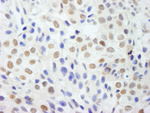 DDX54 Antibody in Immunohistochemistry (IHC)