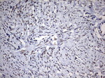 DDX56 Antibody in Immunohistochemistry (Paraffin) (IHC (P))