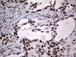 DDX56 Antibody in Immunohistochemistry (Paraffin) (IHC (P))