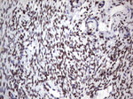 DDX56 Antibody in Immunohistochemistry (Paraffin) (IHC (P))