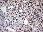 DDX56 Antibody in Immunohistochemistry (Paraffin) (IHC (P))