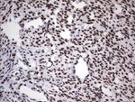 DDX56 Antibody in Immunohistochemistry (Paraffin) (IHC (P))