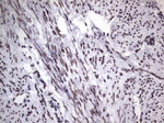 DDX56 Antibody in Immunohistochemistry (Paraffin) (IHC (P))