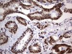 DDX56 Antibody in Immunohistochemistry (Paraffin) (IHC (P))