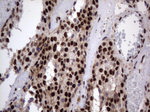 DDX56 Antibody in Immunohistochemistry (Paraffin) (IHC (P))