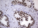 DDX56 Antibody in Immunohistochemistry (Paraffin) (IHC (P))