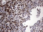 DDX56 Antibody in Immunohistochemistry (Paraffin) (IHC (P))