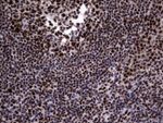 DDX56 Antibody in Immunohistochemistry (Paraffin) (IHC (P))