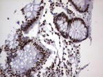 DDX56 Antibody in Immunohistochemistry (Paraffin) (IHC (P))