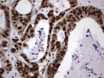 DDX56 Antibody in Immunohistochemistry (Paraffin) (IHC (P))