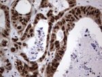 DDX56 Antibody in Immunohistochemistry (Paraffin) (IHC (P))