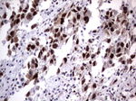 DDX56 Antibody in Immunohistochemistry (Paraffin) (IHC (P))