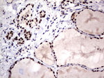 DDX56 Antibody in Immunohistochemistry (Paraffin) (IHC (P))