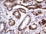 DDX56 Antibody in Immunohistochemistry (Paraffin) (IHC (P))