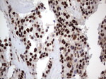 DDX56 Antibody in Immunohistochemistry (Paraffin) (IHC (P))