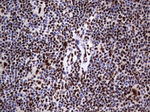 DDX56 Antibody in Immunohistochemistry (Paraffin) (IHC (P))