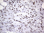 DDX56 Antibody in Immunohistochemistry (Paraffin) (IHC (P))