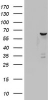 DDX56 Antibody in Western Blot (WB)