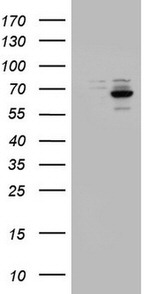 DDX56 Antibody in Western Blot (WB)