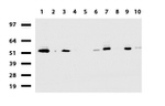 DDX56 Antibody in Western Blot (WB)