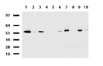 DDX56 Antibody in Western Blot (WB)