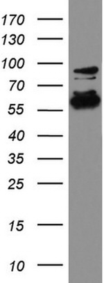 DDX56 Antibody in Western Blot (WB)