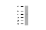 DDX56 Antibody in Western Blot (WB)