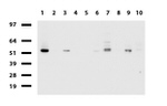 DDX56 Antibody in Western Blot (WB)