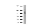 DDX56 Antibody in Western Blot (WB)