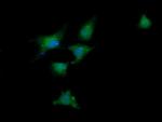 DDX58 Antibody in Immunocytochemistry (ICC/IF)