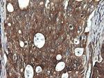 DDX58 Antibody in Immunohistochemistry (Paraffin) (IHC (P))