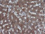 DDX58 Antibody in Immunohistochemistry (Paraffin) (IHC (P))