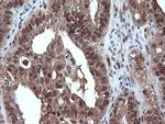 DDX58 Antibody in Immunohistochemistry (Paraffin) (IHC (P))