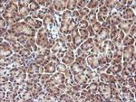 DDX58 Antibody in Immunohistochemistry (Paraffin) (IHC (P))